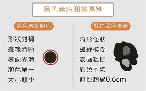 為什麼痣會長毛|為什麼臉上的痣越來越多？皮膚科醫師解析長痣原因、。